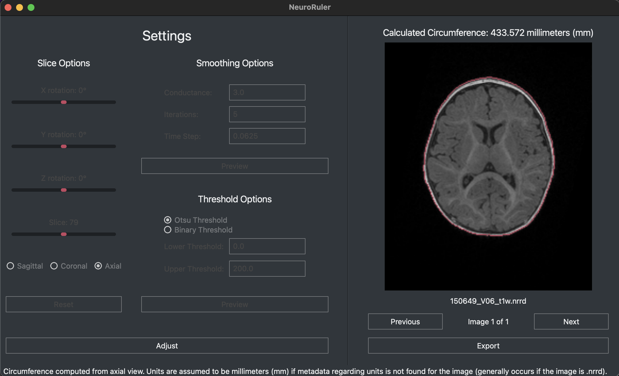 Picture of NeuroRuler computing circumference